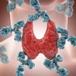 аутоімунний тиреоїдит